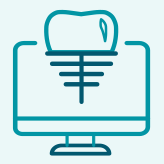 Implantologia computer guidata