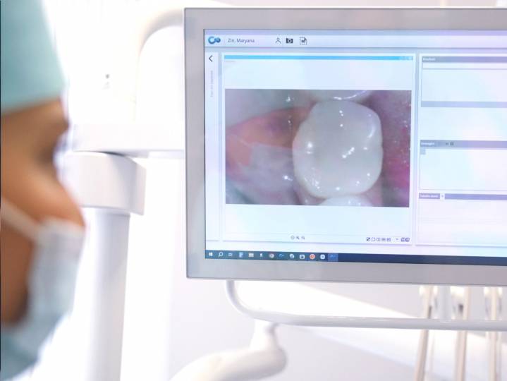 Telecamere diagnostiche intraorali digitali